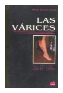 Las varices de  Marcos E. Sevilla